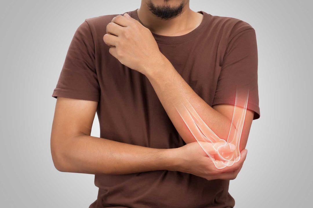Joint Pain and Collagen Supplementation: What the Science Actually Says